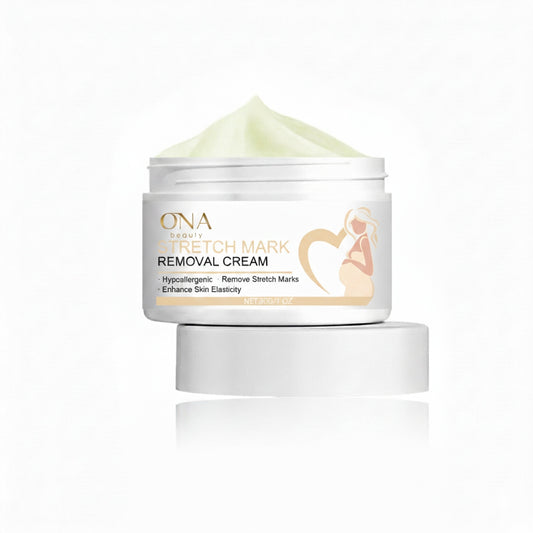 Stretch Mark Prevention Cream